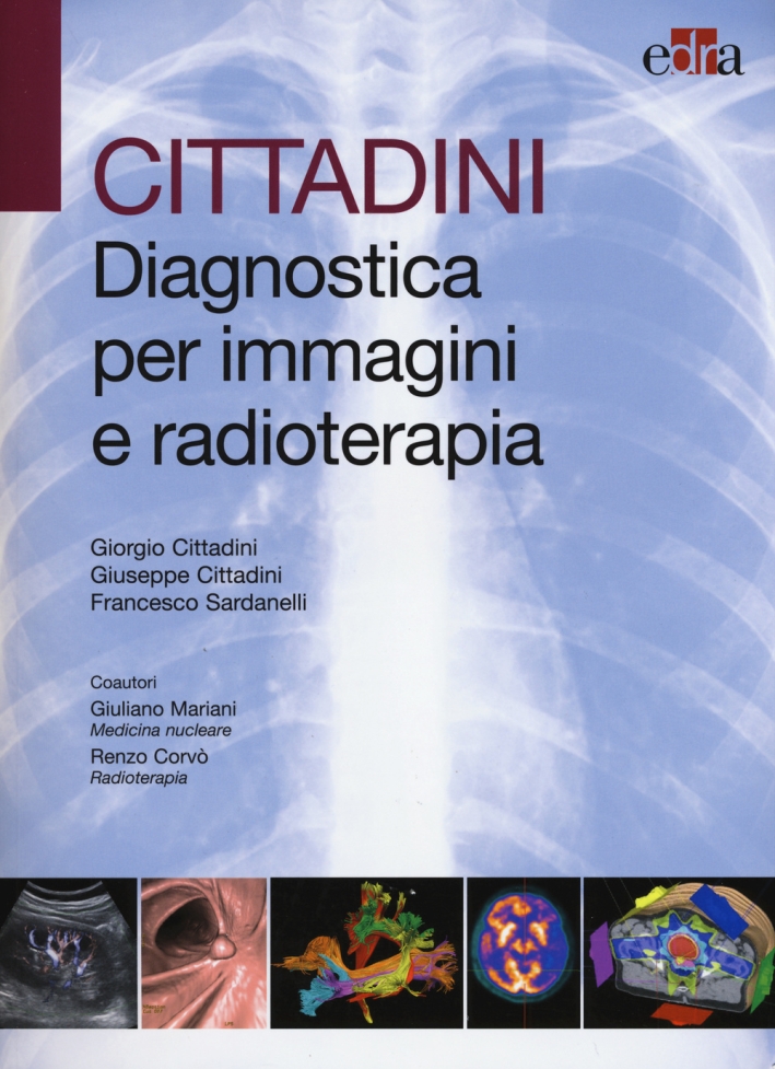 Cittadini. Diagnostica per immagini e radioterapia. Ediz. illustrata Cittadini. Diagnostica per immagini e radioterapia. Ediz. illustrata