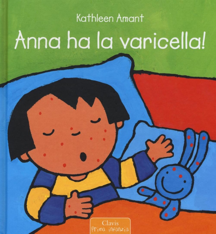 Anna ha la varicella! Ediz. illustrata Anna ha la varicella! Ediz. illustrata