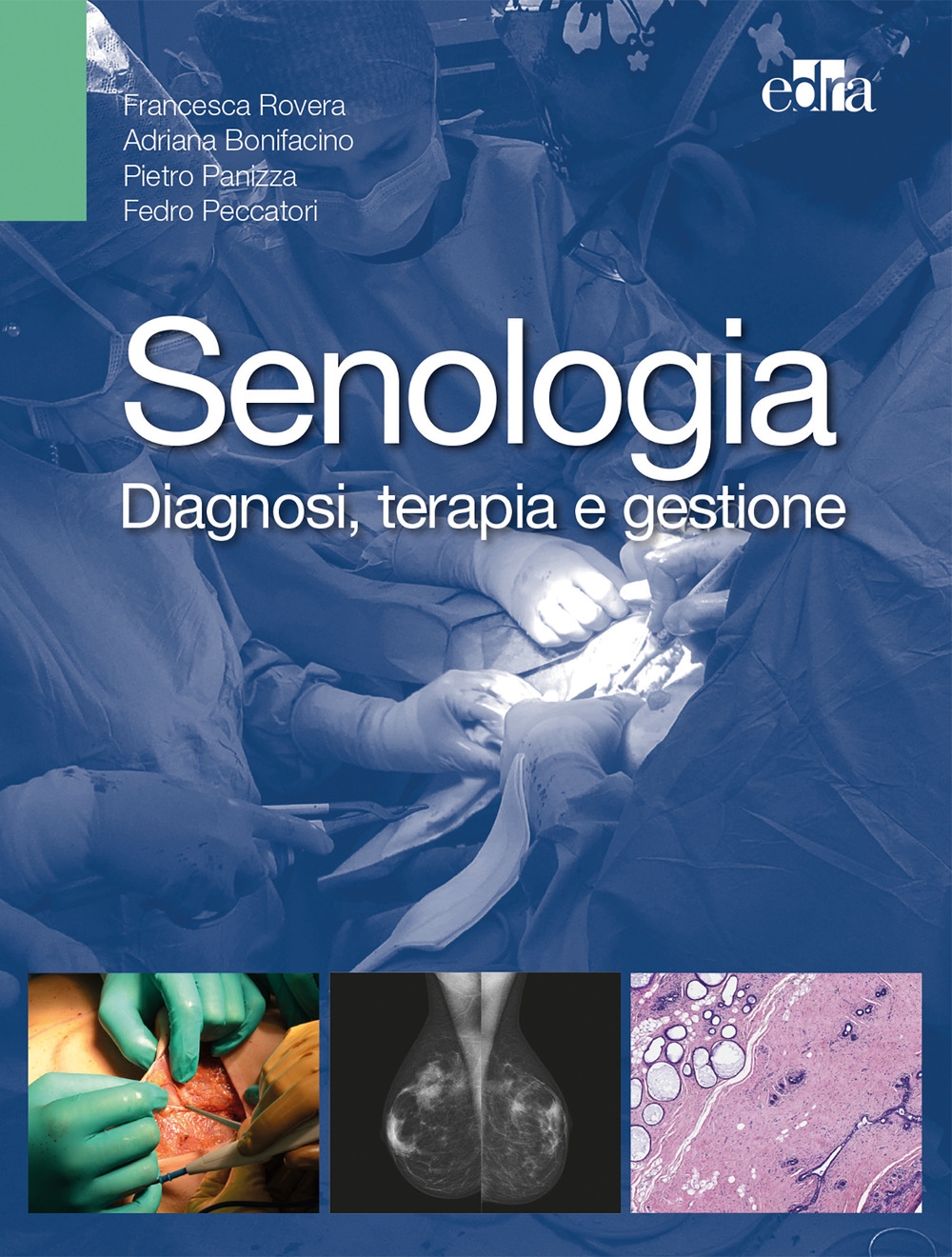 Senologia. Diagnosi, terapia e gestione Senologia. Diagnosi, terapia e gestione