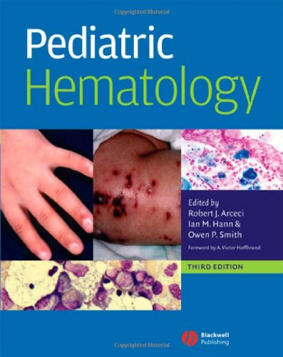 Pediatric Hematology Pediatric Hematology