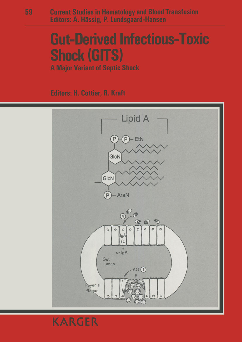 Gut-Derived Infectious-Toxic Shock Gut-Derived Infectious-Toxic Shock