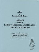 Atlas of Tumor Patology. Tumors of the Kidney and Bladder: 11 Atlas of Tumor Patology. Tumors of the Kidney and Bladder: 11