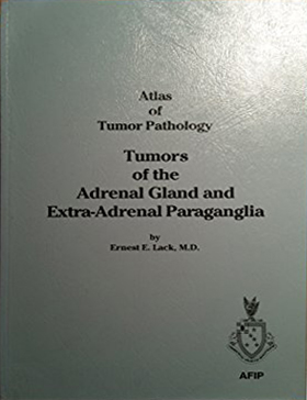 Atlas of Tumor Patology. Tumors of the Adrenal Gland and Extra-Adrenal Paraganglia Atlas of Tumor Patology. Tumors of the Adrenal Gland and Extra-Adrenal Paraganglia