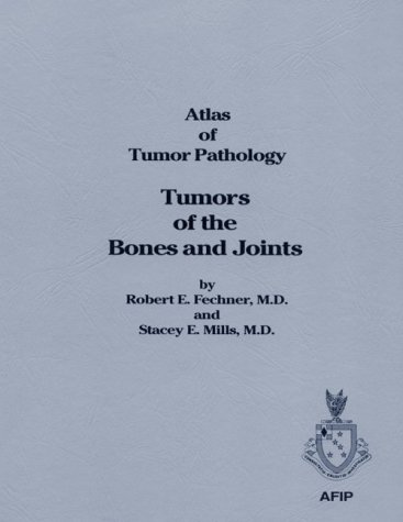 Atlas of Tumor Patology. Tumors of Bones and Joints: 8 Atlas of Tumor Patology. Tumors of Bones and Joints: 8