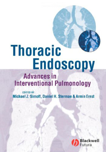 Thoracic Endoscopy: Advances in Interventional Pulmonology Thoracic Endoscopy: Advances in Interventional Pulmonology