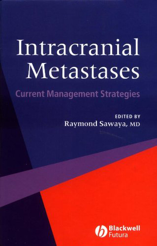 Intracranial Metastases: Current Management Strategies Intracranial Metastases: Current Management Strategies