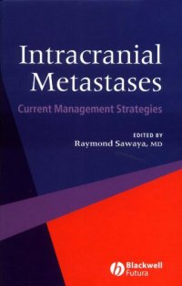 Intracranial Metastases: Current Management Strategies