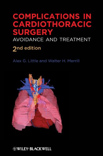 Complications in Cardiothoracic Surgery: Avoidance and Treatment Complications in Cardiothoracic Surgery: Avoidance and Treatment