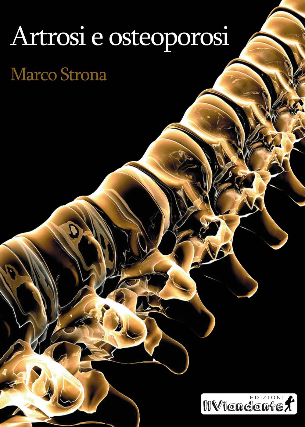 Artrosi e osteoporosi Artrosi e osteoporosi
