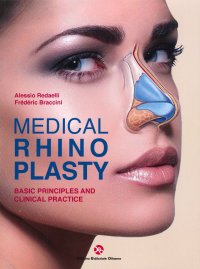 Medical rhinoplasty. Basic principles and clinical practice